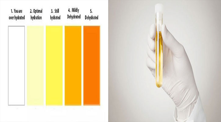মূত্রের রং দেখে জেনে নিন শারীরিক অবস্থা কেমন