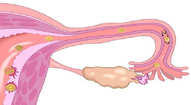 ওভুলেশন বা ডিম্বোস্ফোটন কি?