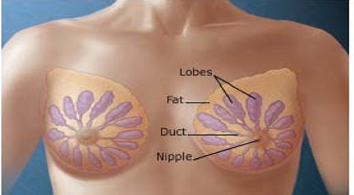 Signs of Breast Cancer