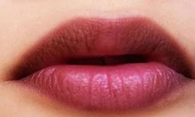 ঠোঁটের কোনার কালচে দাগ দূর করার উপায়